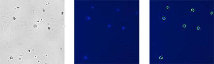 Cellometer Images of Sample 2: SVF stained with HO+PI