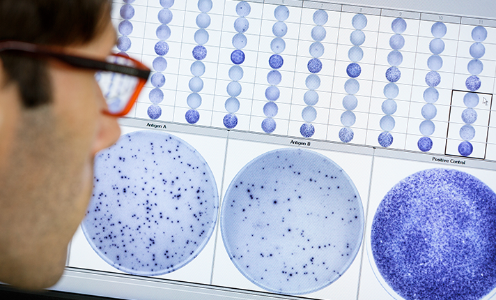 T cell immunology T-spot technology