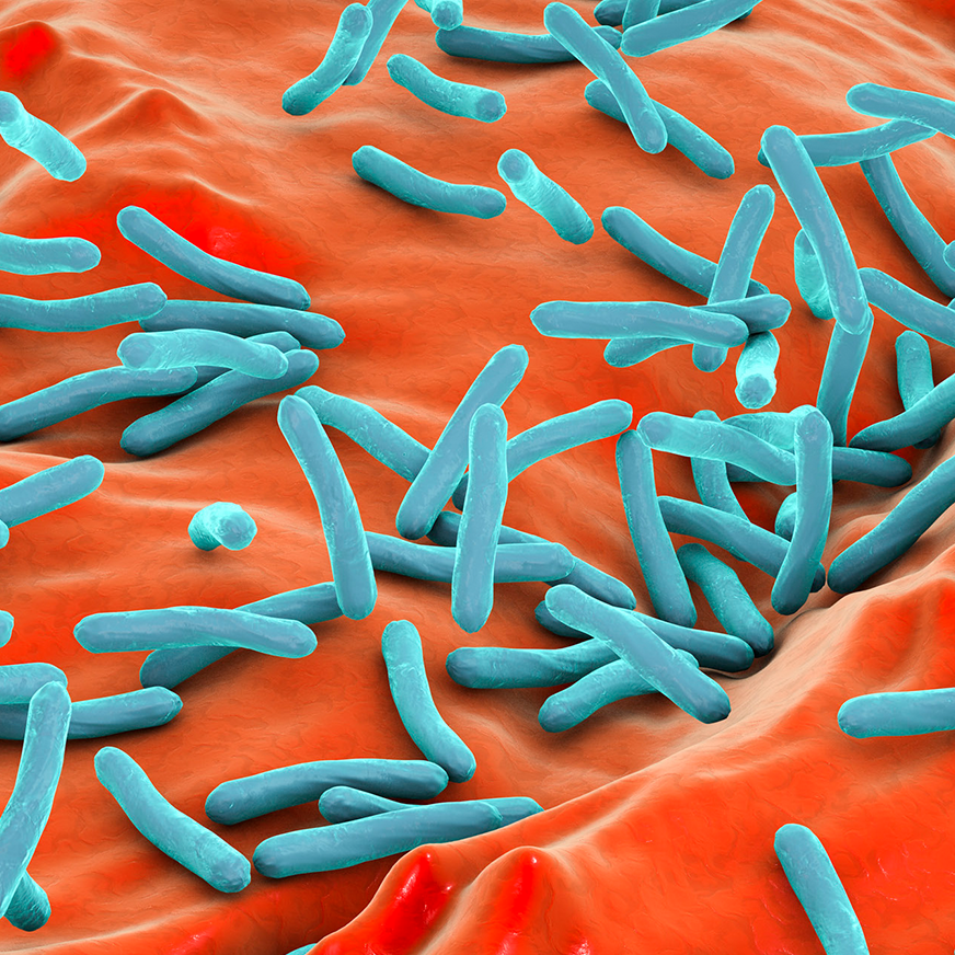 tb-management-hero-872x872