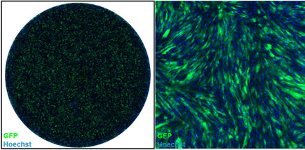 Transduced fibroblasts