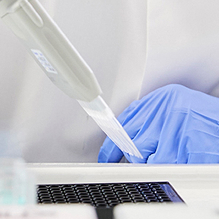 Transfection and Ancillary Reagents