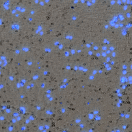 Transwell DAPI bright field overlay