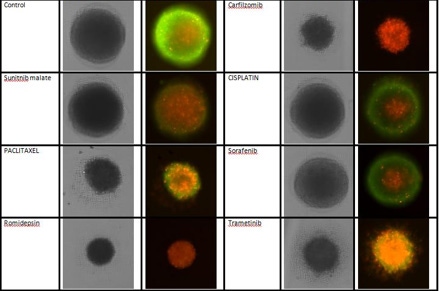 Treated 3D tumor spheroids 1