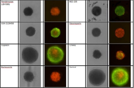 Treated 3D tumor spheroids 2