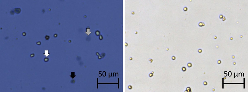 trypan-blue-stained-cells-fig1-850x315