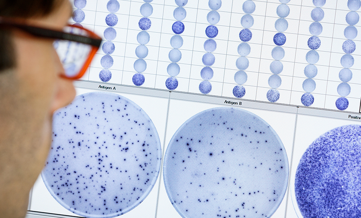 tuberculosis testing services