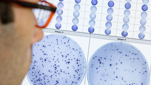 tuberculosis testing services