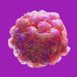 tumor-invasion-metastasis