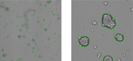  Tumor sphere analysis