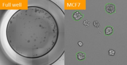 Tumorsphere formation MCF7