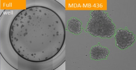 Tumorsphere formation MDA MB 436