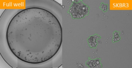 Tumorsphere formation SKBR3