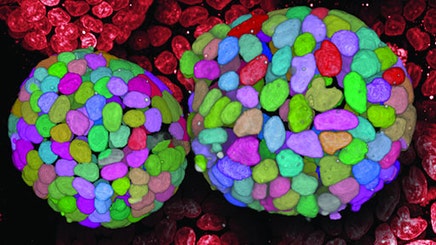 upscaling-organoid512