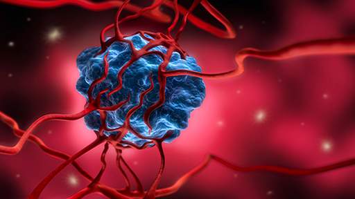 vega-ultrasound-renal512