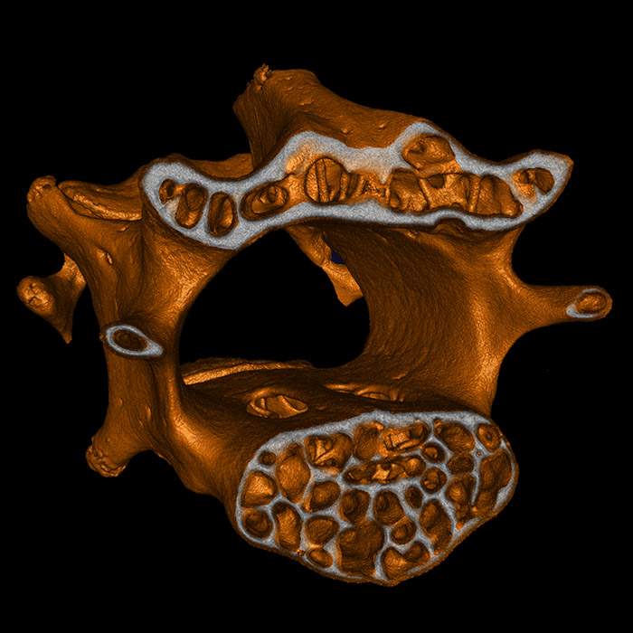 Mouse vertebrae imaged on the Quantum GX3 microCT system
