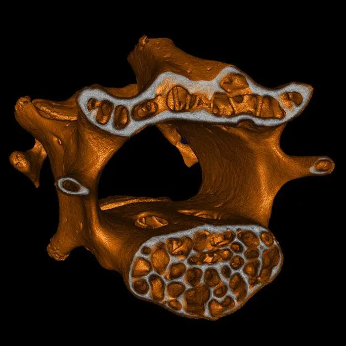 Mouse vertebrae imaged on the Quantum GX3 microCT system