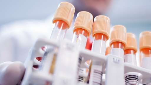 volume-serum-plasma1920x640