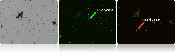 Yeast AOPI