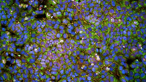 your-questions-answered512